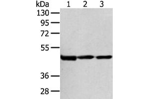 Western Blotting (WB) image for anti-1-Acylglycerol-3-Phosphate O-Acyltransferase 9 (AGPAT9) antibody (ABIN5960644) (AGPAT9 Antikörper)