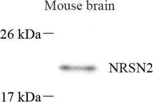 Western blot analysis of NRSN2 (ABIN7074806) at dilution of 1: 500 (NRSN2 Antikörper)