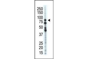 Western Blotting (WB) image for anti-Salt-Inducible Kinase 1 (SIK1) (C-Term) antibody (ABIN360572) (SIK1 Antikörper  (C-Term))