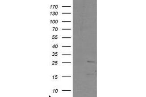 Image no. 1 for anti-PYD and CARD Domain Containing (PYCARD) antibody (ABIN1500519) (PYCARD Antikörper)