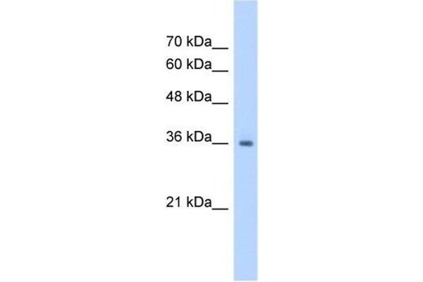 RSU1 Antikörper  (C-Term)