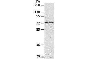 Western blot analysis of PC3 cell, using ADAM10 Polyclonal Antibody at dilution of 1:300 (ADAM10 Antikörper)