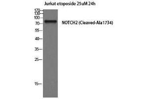 Western Blotting (WB) image for anti-Notch 2 (NOTCH2) (Cleaved-Ala1734), (Internal Region) antibody (ABIN6281639) (NOTCH2 Antikörper  (Cleaved-Ala1734, Internal Region))