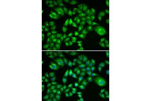 Immunofluorescence analysis of A549 cells using H6PD antibody (ABIN5973840). (Glucose-6-Phosphate Dehydrogenase Antikörper)