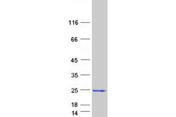 GCAP1 Protein (Myc-DYKDDDDK Tag)