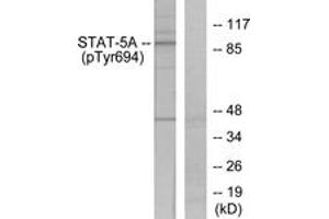 Western blot analysis of extracts from HeLa cells treated with EGF, using STAT5A (Phospho-Tyr694) Antibody. (STAT5A Antikörper  (pTyr694))