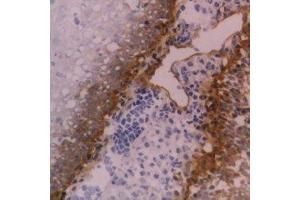 Immunohistochemistry (IHC) image for anti-Integrin beta 4 (ITGB4) antibody (ABIN2478034) (Integrin beta 4 Antikörper)