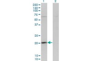 Western Blot analysis of GPSM3 expression in transfected 293T cell line by GPSM3 monoclonal antibody (M01), clone 1F11. (GPSM3 Antikörper  (AA 1-160))