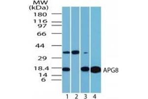 Image no. 3 for anti-Microtubule-Associated Protein 1 Light Chain 3 alpha (MAP1LC3A) (AA 1-50) antibody (ABIN207748) (MAP1LC3A Antikörper  (AA 1-50))