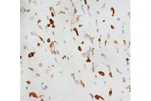 Immunohistochemistry with CBFA1 Polyclonal Antibody (RUNX2 Antikörper  (C-Term))