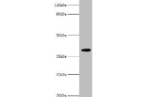 Western blot analysis of recombinant Carboxypeptidase G2 (0. (Carboxypeptidase G2 Antikörper  (AA 23-415))