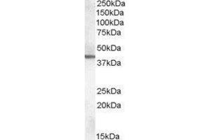 Western Blotting (WB) image for Abhydrolase Domain Containing 12 (ABHD12) peptide (ABIN369756) (Abhydrolase Domain Containing 12 (ABHD12) Peptid)