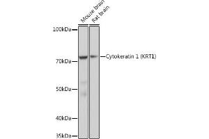 Western blot analysis of extracts of various cell lines, using Cytokeratin 1 (KRT1) (KRT1) Rabbit mAb (ABIN7268085) at 1:1000 dilution. (Cytokeratin 1 Antikörper)