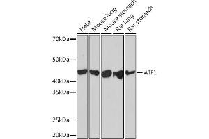 Western blot analysis of extracts of various cell lines, using WIF1 Rabbit mAb (ABIN7271383) at 1:1000 dilution. (WIF1 Antikörper)