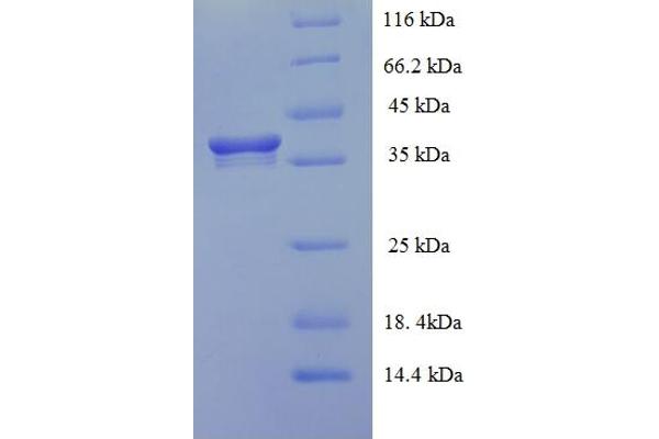 HEBP2 Protein (AA 2-205) (His-SUMO Tag)