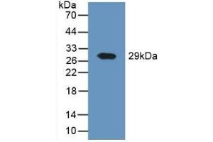 Detection of Recombinant DPP4, Human using Polyclonal Antibody to Cluster Of Differentiation 26 (CD26) (DPP4 Antikörper  (AA 484-728))