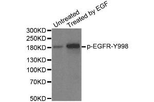 Western Blotting (WB) image for anti-Epidermal Growth Factor Receptor (EGFR) (pTyr1172) antibody (ABIN1870117) (EGFR Antikörper  (pTyr1172))