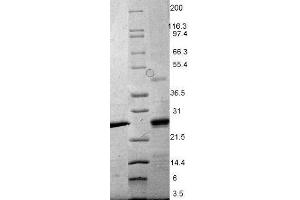 EBI-3 Mouse Recombinant Protein - SDS-PAGE. (EBI3 Protein)