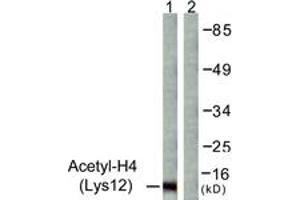Western blot analysis of extracts from COS7 cells, treated with TSA 400nM 24h, using Histone H4 (Acetyl-Lys12) Antibody. (Histone H4 Antikörper  (acLys12))