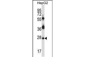 Western blot analysis in HepG2 cell line lysates (35ug/lane). (TP53RK Antikörper  (AA 100-128))