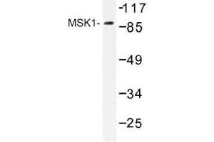 Image no. 1 for anti-Ribosomal Protein S6 Kinase, 90kDa, Polypeptide 5 (RPS6KA5) antibody (ABIN317778) (MSK1 Antikörper)