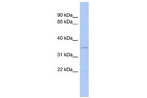 WB Suggested Anti-CLEC4G Antibody Titration: 0. (CLEC4G Antikörper  (N-Term))