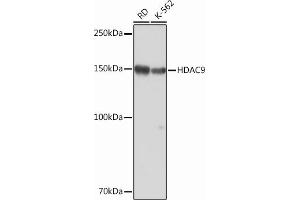 Western blot analysis of extracts of various cell lines, using HD Rabbit mAb (ABIN1680476, ABIN3015870, ABIN3015871 and ABIN7101453) at 1:1000 dilution. (HDAC9 Antikörper)
