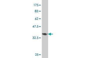 Western Blot detection against Immunogen (38. (PTPLAD1 Antikörper  (AA 1-113))