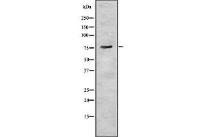 Western blot analysis of BDKRB2 using HuvEc whole cell lysates (BDKRB2 Antikörper  (Internal Region))