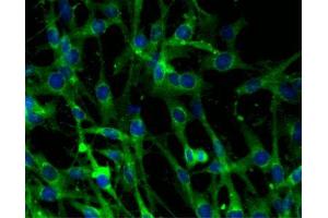 Immunofluorescence (IF) image for anti-Clathrin (AA 4-171) antibody (ABIN968006)