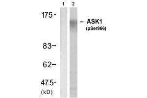 Image no. 1 for anti-Mitogen-Activated Protein Kinase Kinase Kinase 5 (MAP3K5) (pSer966) antibody (ABIN273525) (ASK1 Antikörper  (pSer966))