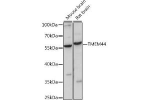 Western blot analysis of extracts of various cell lines, using TMEM44 antibody (ABIN7270964) at 1:1000 dilution. (TMEM44 Antikörper  (AA 110-260))