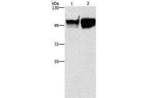 Western Blot analysis of Hela and raji cell using CD54 Polyclonal Antibody at dilution of 1:350 (ICAM1 Antikörper)
