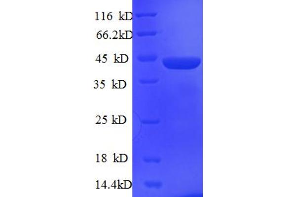 SRSF1 Protein (AA 2-248) (His-SUMO Tag)