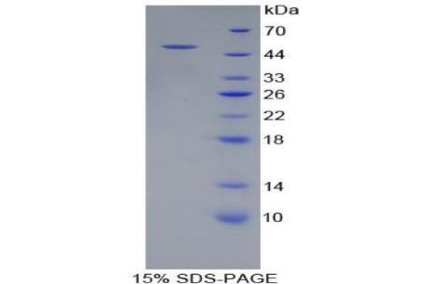 PSMC2 Protein