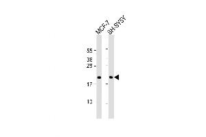 Western Blot at 1:2000 dilution Lane 1: MCF-7 whole cell lysate Lane 2: SH-SY5Y whole cell lysate Lysates/proteins at 20 ug per lane. (BTG1 Antikörper  (AA 92-118))