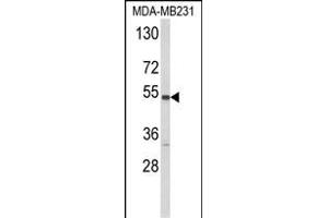 Western blot analysis of CYP2A13 Antibody (C-term) (ABIN652591 and ABIN2842396) in MDA-M cell line lysates (35 μg/lane). (CYP2A13 Antikörper  (C-Term))