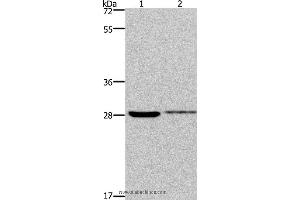 Western blot analysis of 231 and Hela cell, using CDK1 Polyclonal Antibody at dilution of 1:300 (CDK1 Antikörper)