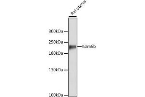 Western blot analysis of extracts of various cell lines, using Kdm6b antibody (ABIN6131825, ABIN6142807, ABIN6142810 and ABIN6216508) at 1:3000 dilution. (Kdm6b Antikörper  (AA 1161-1350))