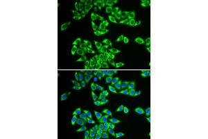 Immunofluorescence analysis of HeLa cells using DDX3X antibody. (DDX3X Antikörper)