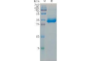 HIST1H1C Protein (Fc Tag)