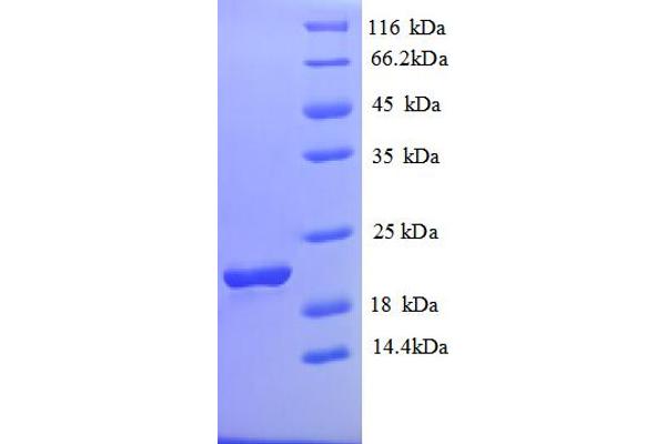 SLC41A2 Protein (AA 1-162, Extracellular) (His tag)