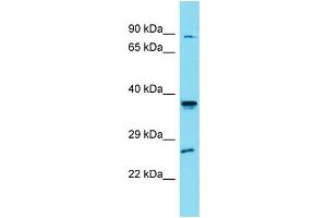 Western Blotting (WB) image for anti-Solute Carrier Family 35, Member G4 (SLC35G4) (N-Term) antibody (ABIN2505580) (SLC35G4 Antikörper  (N-Term))