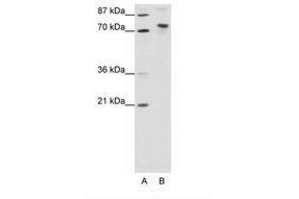 TOX4 Antikörper  (N-Term)