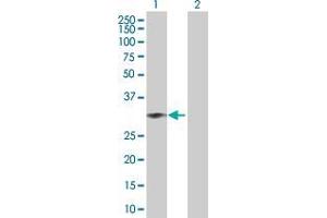 Lane 1: CENPH transfected lysate ( 27. (CENPH 293T Cell Transient Overexpression Lysate(Denatured))