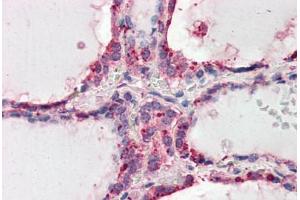 Human Thyroid (formalin-fixed, paraffin-embedded) stained with WNT3 antibody ABIN461935 at 3. (WNT3 Antikörper  (AA 315-329))