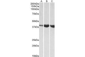 ABIN4902524 (1µg/ml) staining of Human (A), Mouse (B) and Rat (C) Skeletal Muscle lysates (35µg protein in RIPA buffer). (ALDOA Antikörper)