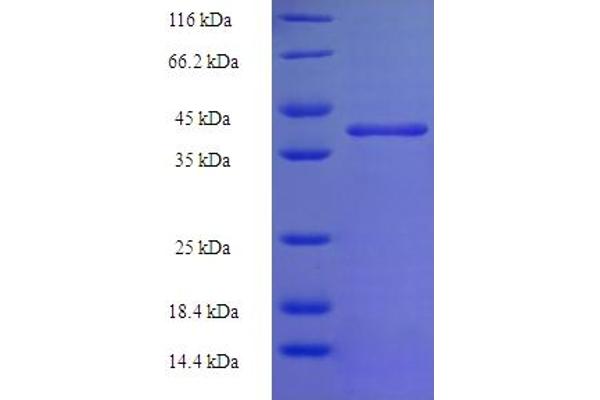 N6AMT2 Protein (AA 2-214) (His-SUMO Tag)