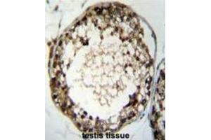 Immunohistochemistry (IHC) image for anti-Testis Specific Serine Kinase 4 (TSSK4) antibody (ABIN2996104) (TSSK4 Antikörper)