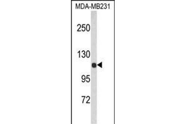 ACTN1 Antikörper  (N-Term)